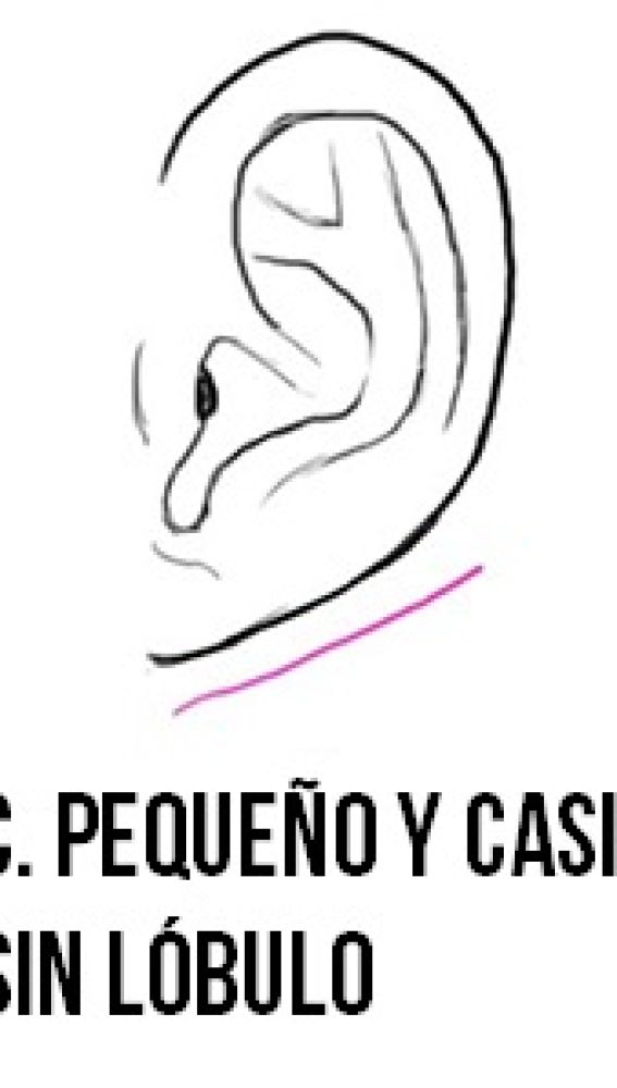 Lóbulo pequeño