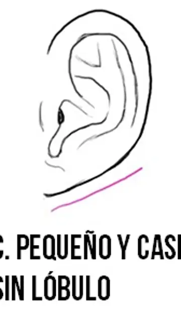 Lóbulo pequeño Lóbulo pequeño