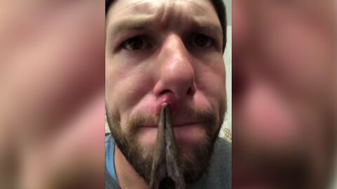 Christopher Yocom sacándose el grano