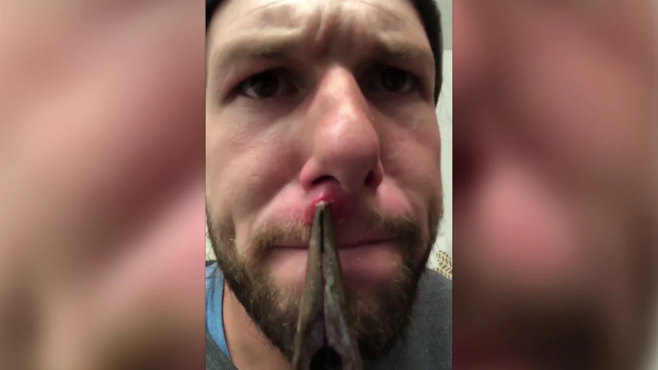 Christopher Yocom sacándose el grano