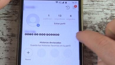 La realidad que no se ve en las redes dos meses después de ser atacada con ácido