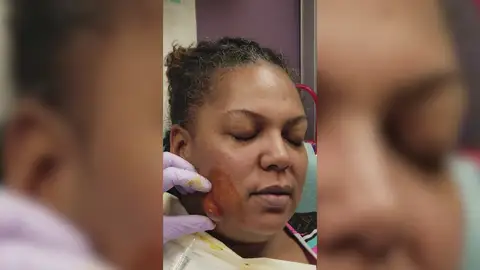 El doctor curando el grano de Nicole Marbury El doctor curando el grano de Nicole Marbury