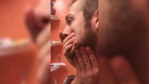 Explotándose un grano en el baño Explotándose un grano en el baño