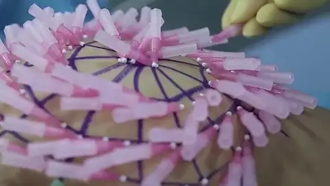 Operación de culo Operación de culo