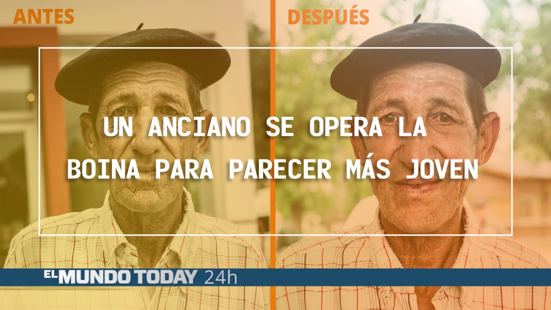 Un anciano se opera la boina