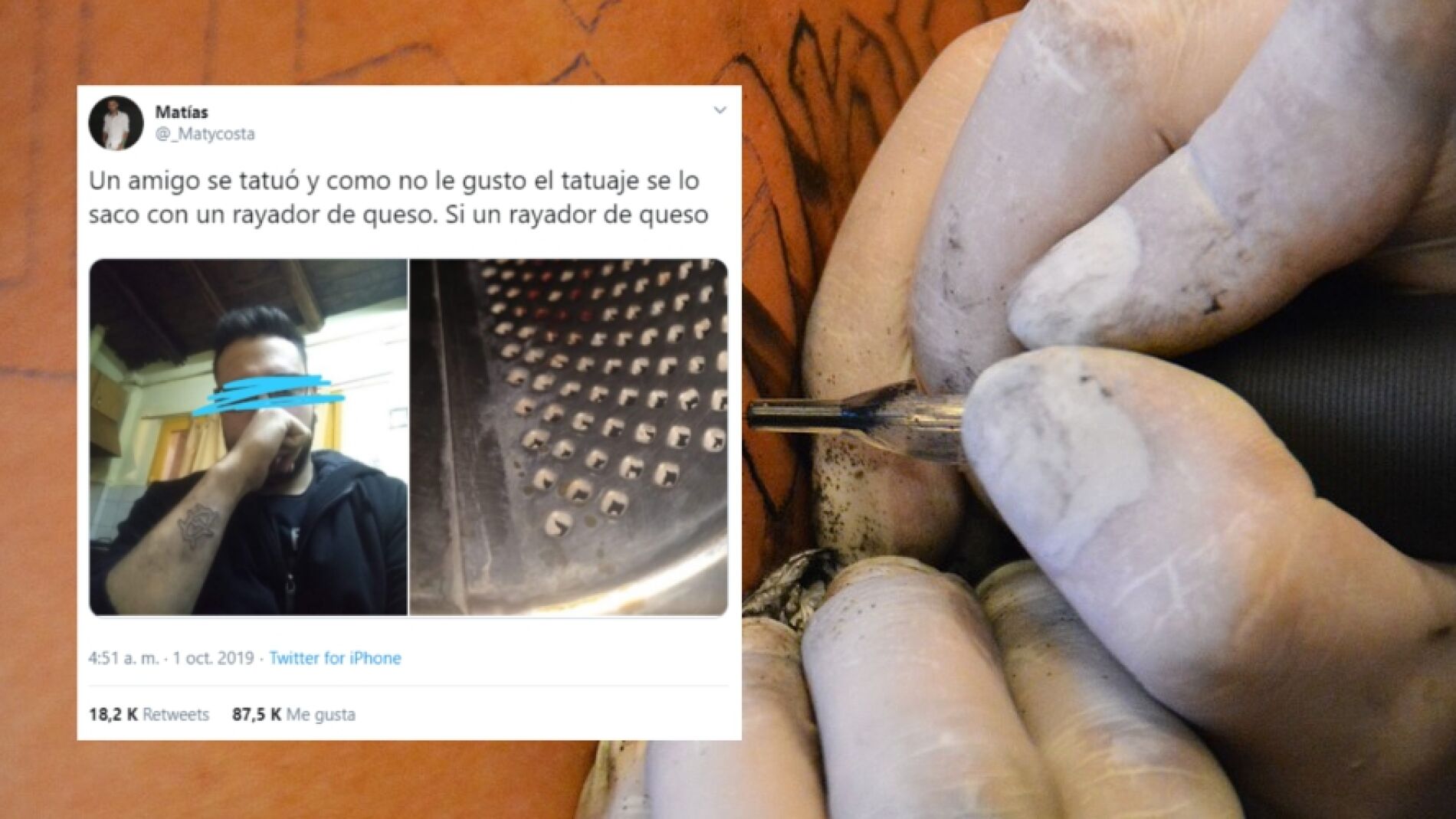 Se quita un tatuaje con un rayador de queso