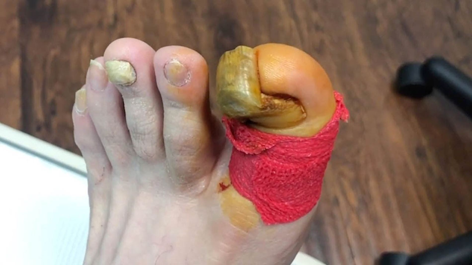 U&ntilde;a gigantesca