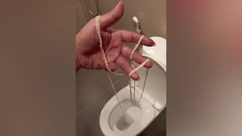 Va al baño y expulsa una tenia viva Va al baño y expulsa una tenia viva