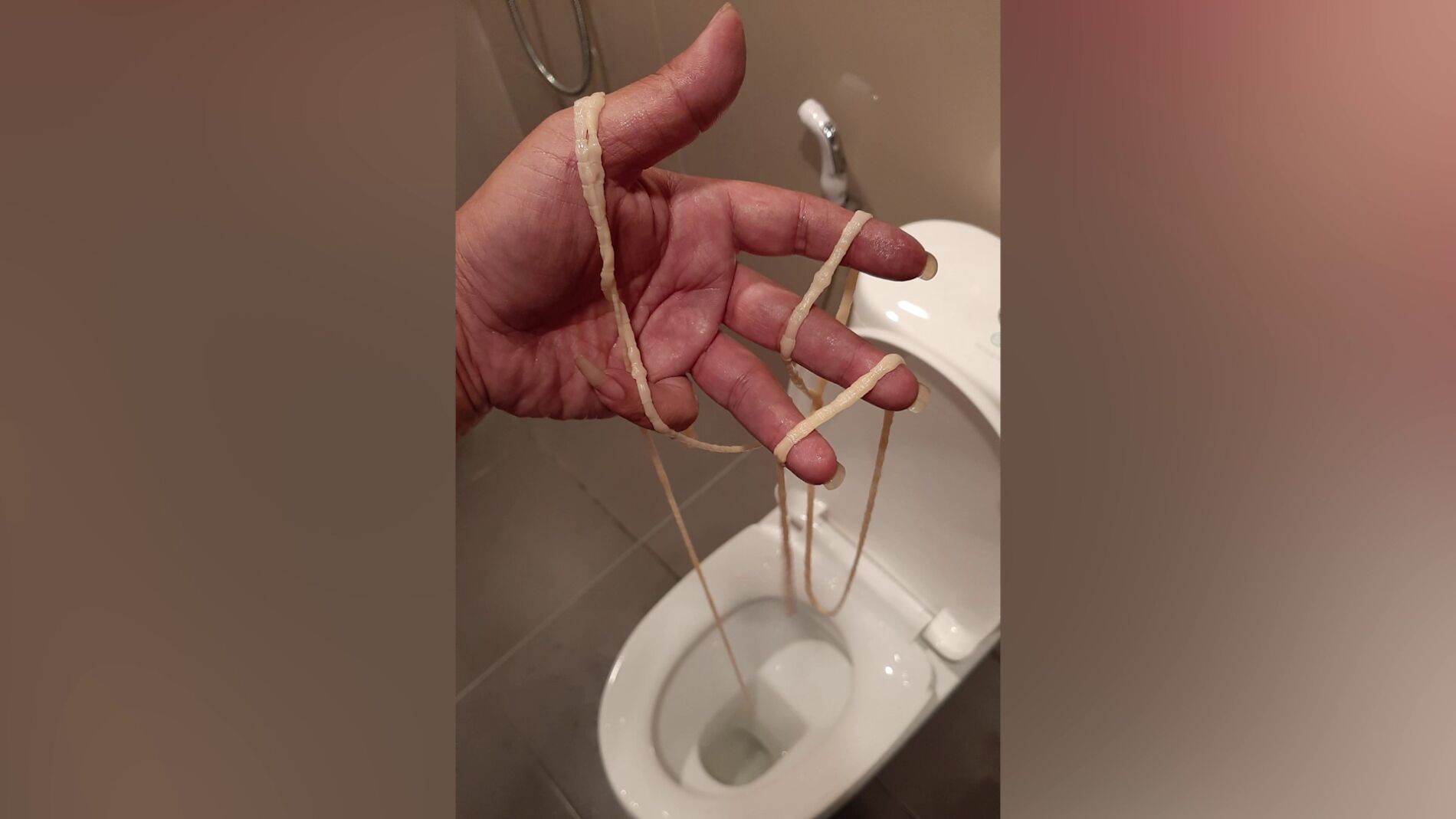 heces humanas con tenia