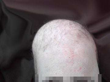 No es una cabeza, es una rodilla
