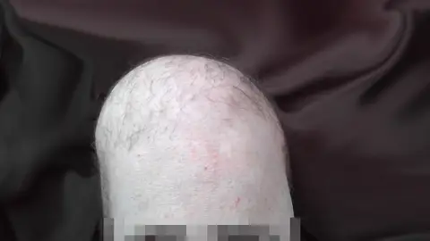 No es una cabeza, es una rodilla No es una cabeza, es una rodilla