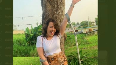 El zasca de una chica con una pierna contra sus haters que ha inspirado Pixar