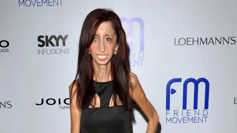 La activista Lizzie Velasquez La activista Lizzie Velasquez