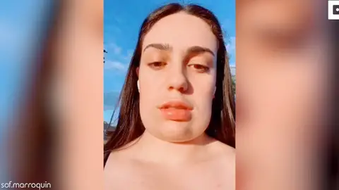 fue a hacerse un tratamiento de belleza y se quedó con la “cabeza cuadrada” fue a hacerse un tratamiento de belleza y se quedó con la “cabeza cuadrada”