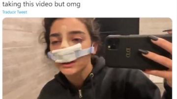 Dixie D'Amelio justo después de su rinoplastia