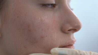 Productos de belleza que deberías empezar a utilizar en la adolescencia