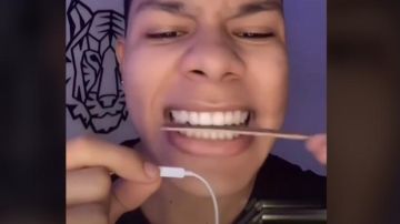 La peligrosa tendencia de limarse los dientes