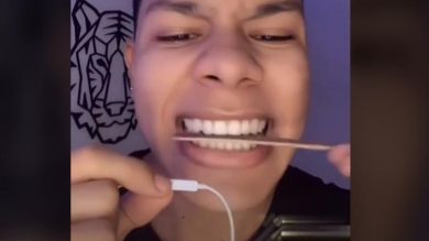 La peligrosa tendencia de TikTok para limarse los dientes