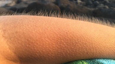 Por qué se nos eriza el pelo cuando escuchamos una canción que nos gusta 