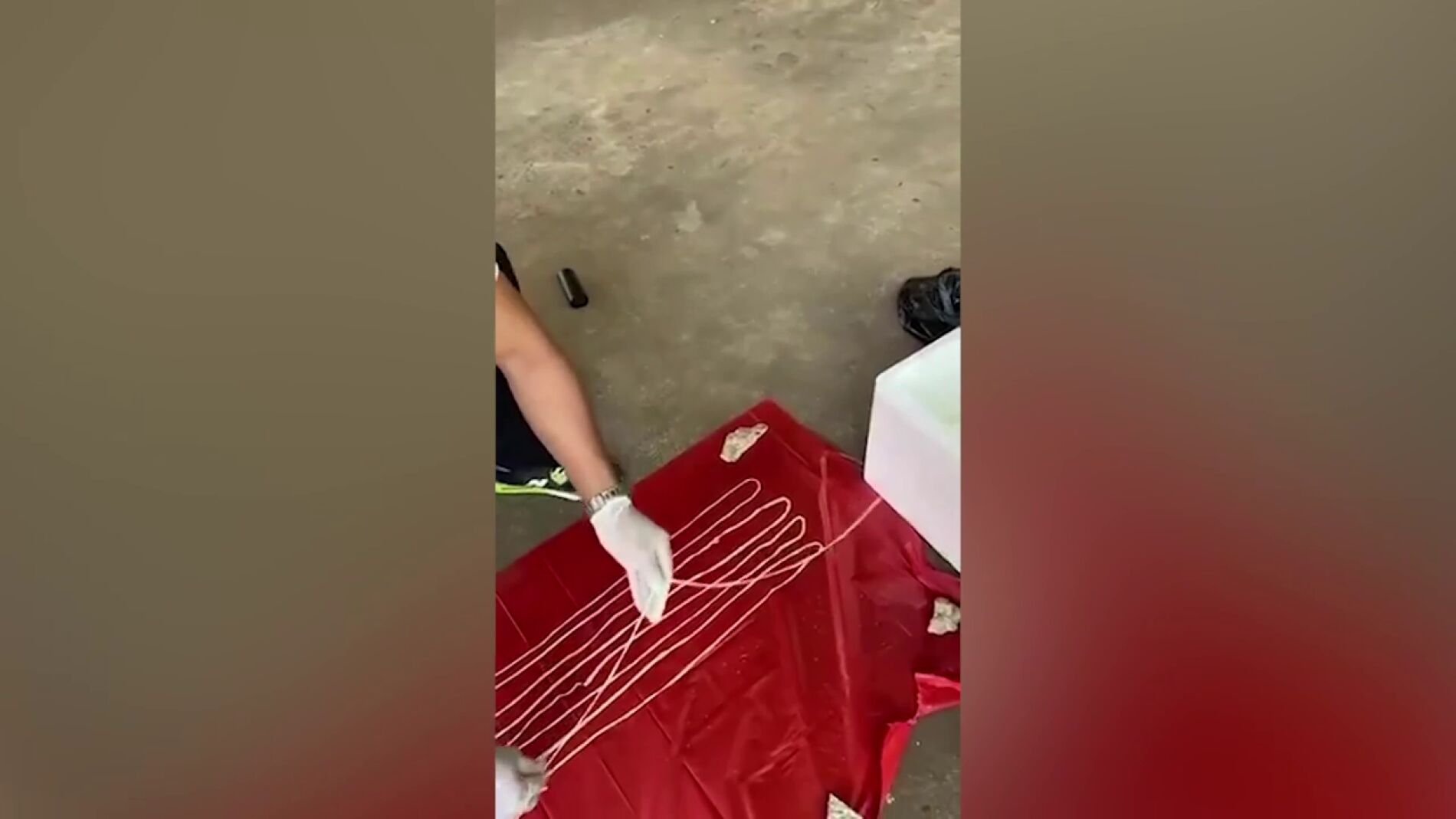 M&eacute;dicos sorprendidos encuentran tenia de 17 metros de largo en el trasero de un hombre