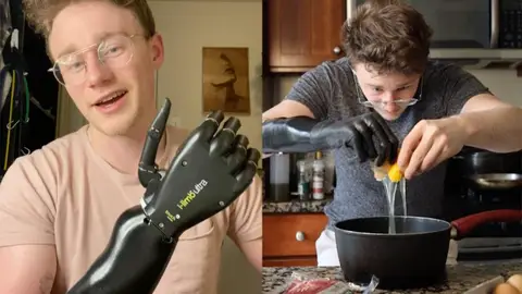 Mano biónica Mano biónica