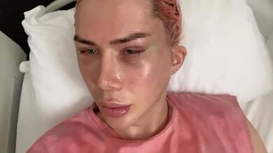 Un youtuber se opera 18 veces para parecerse a Jimin de BTS