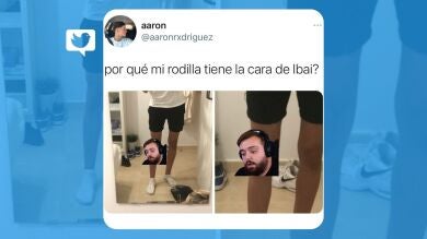 La rodilla con la cara de Ibai que estremece a Twitter