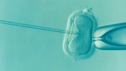 Fecundación in vitro Fecundación in vitro