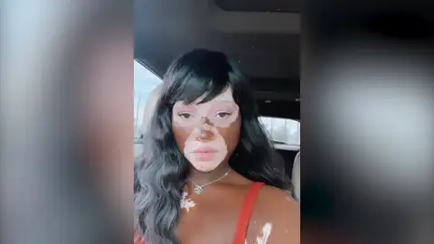 La sorprendente historia de una mujer negra que se está convirtiendo poco a poco en blanca La sorprendente historia de una mujer negra que se está convirtiendo poco a poco en blanca