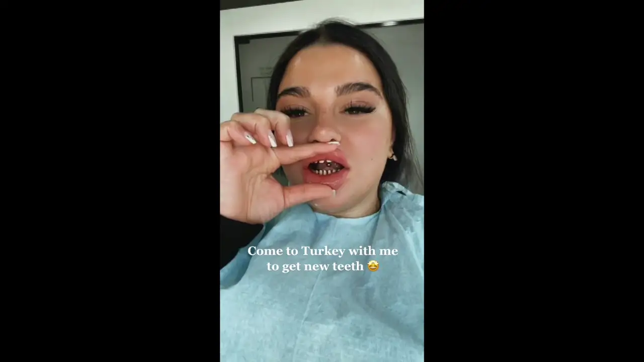 Una mujer se vuelve viral tras una controvertida cirugía dental "asesinó sus dientes"