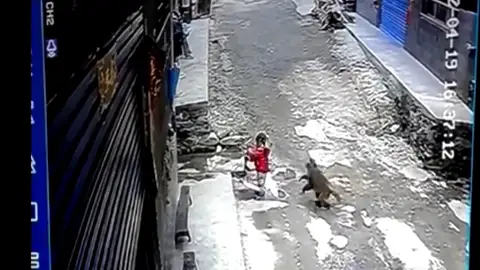 Una niña de 3 años atacada por un mono Una niña de 3 años atacada por un mono