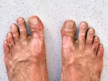 Pies sucios