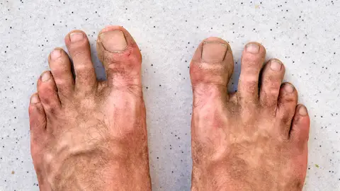 Pies sucios Pies sucios