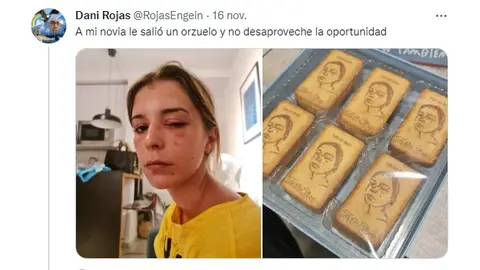 Le sale un orzuelo a su novia y la trolea de forma épica Le sale un orzuelo a su novia y la trolea de forma épica