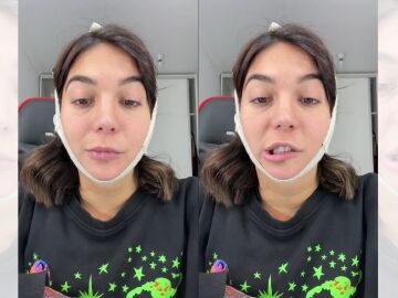 TikTok viral de Luciana Milessi en el que reflexiona sobre las operaciones estéticas y su parálisis facial.