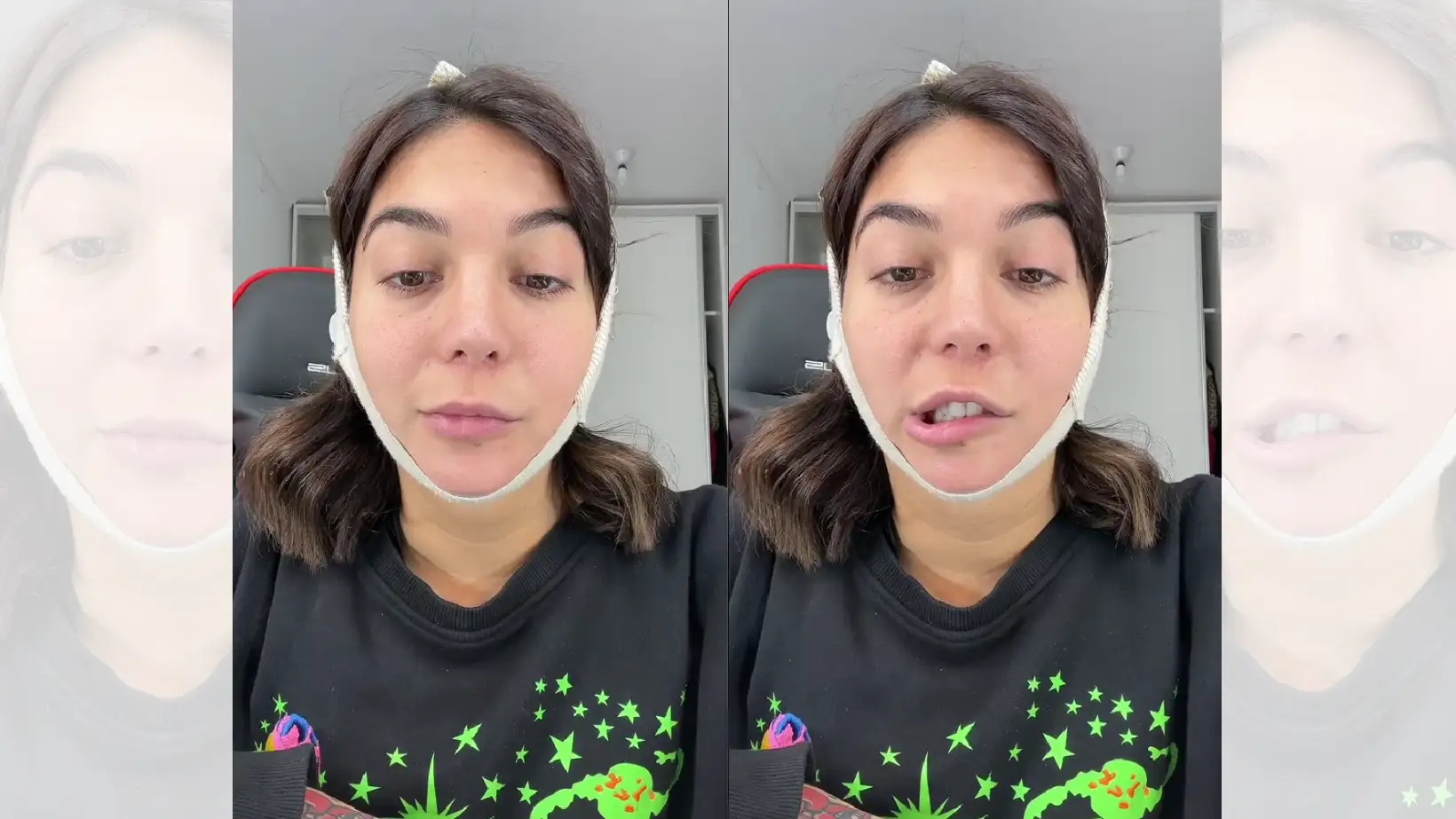 TikTok viral de Luciana Milessi en el que reflexiona sobre las operaciones estéticas y su parálisis facial.