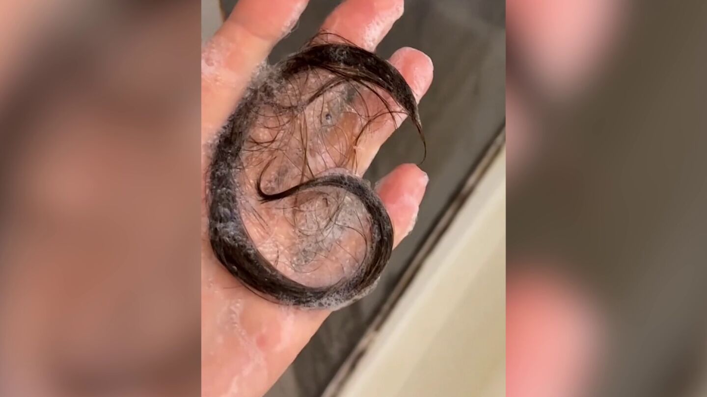 El pelo que perdi&oacute; Nick