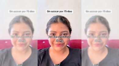 La sorprendente transformación de una chica después de dejar el azúcar por 75 días