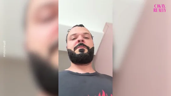 Se tiñe la barba para el día de su boda pero sale terriblemente mal Se tiñe la barba para el día de su boda pero sale terriblemente mal