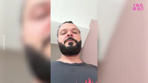 Se tiñe la barba para el día de su boda pero sale terriblemente mal Se tiñe la barba para el día de su boda pero sale terriblemente mal