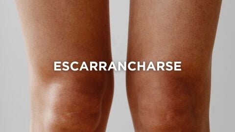 Expresiones extremeñas - Escarrancharse
