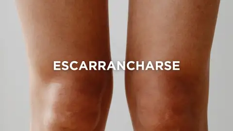 Expresiones extremeñas - Escarrancharse Expresiones extremeñas - Escarrancharse