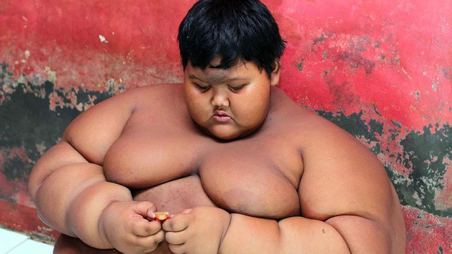 A sus 10 años, Arya Permana pesaba 200 kilos. A sus 10 años, Arya Permana pesaba 200 kilos.