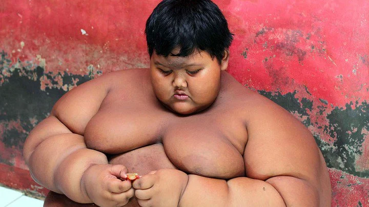 A sus 10 años, Arya Permana pesaba 200 kilos.