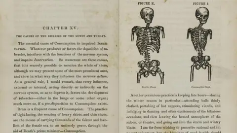 Popular pathology: Pancoast on the curability of consumption: medicated inhalation. 1855. Popular pathology: Pancoast on the curability of consumption: medicated inhalation. 1855.