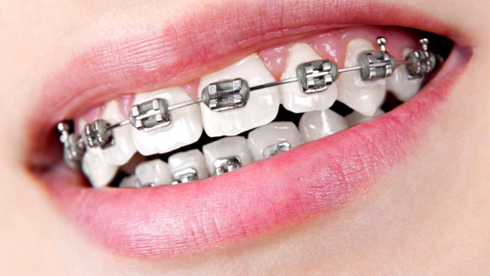 “Me pone ver porno en el que los performers tengan aparato dental”