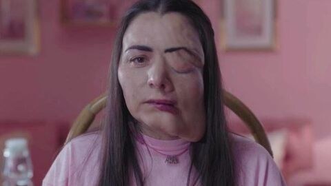 Pieles, de Eduardo Casanova