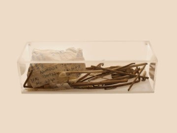 artefactos usados durante un aborto ilegal en Uganda 2002
