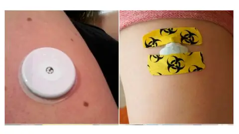 Sensores para enfermos de diabetes Sensores para enfermos de diabetes