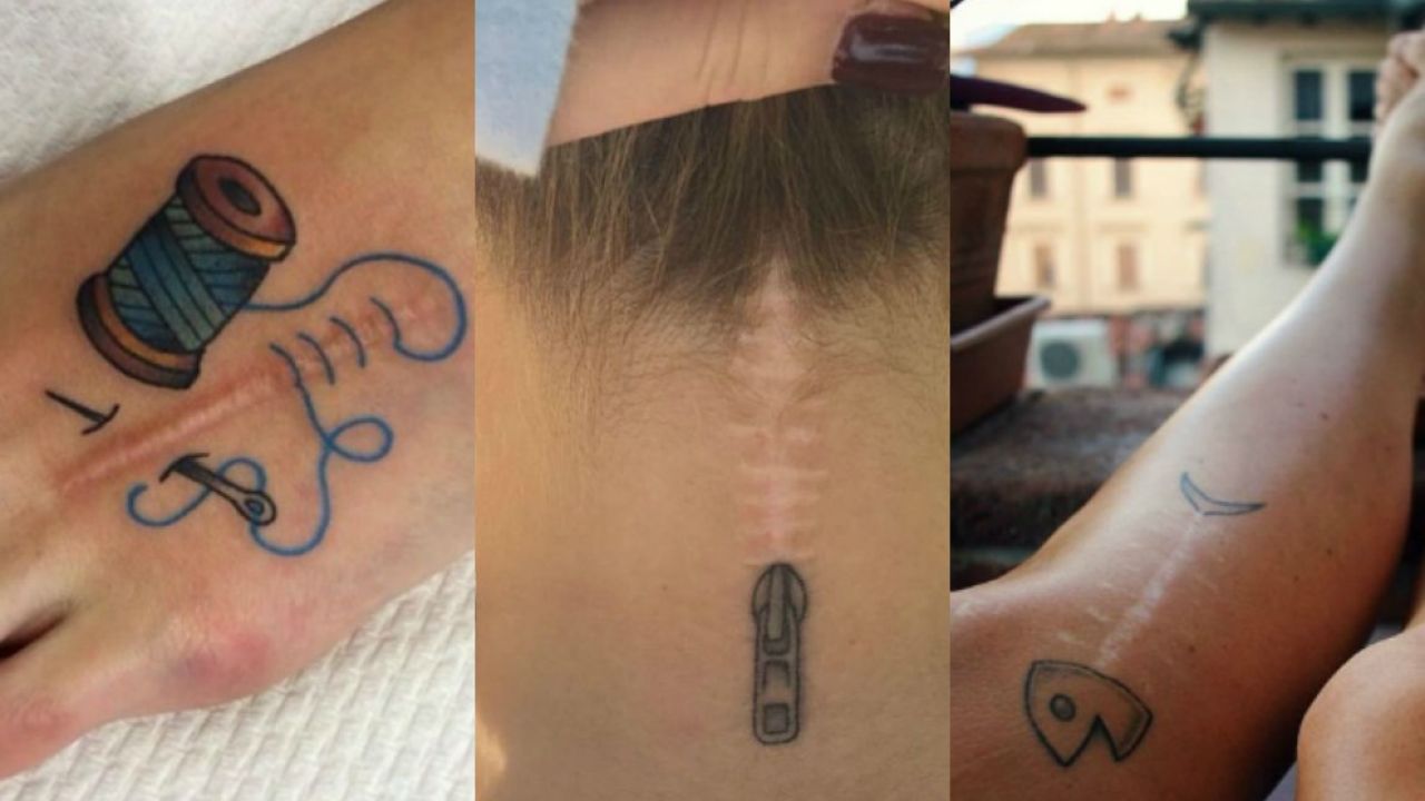 8 increíbles tatuajes que transforman cicatrices en obras de arte